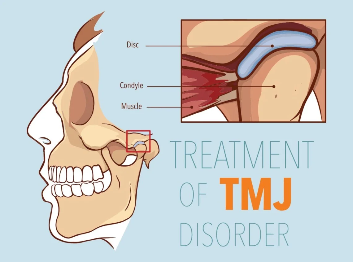 TMJ disorder treatment Balwyn