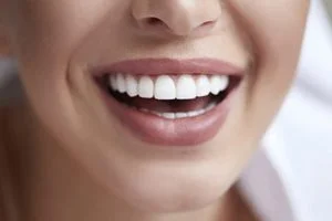 teeth straightening by a dentist in Templestowe Lower